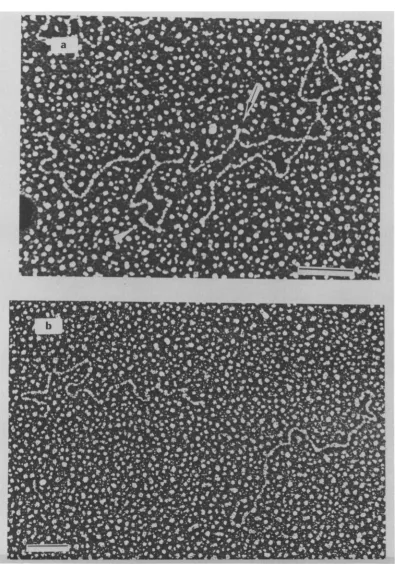 FIG. 6.detailedtreatedTriangles Electron micrographs of RD-114 RNA spread by the glyoxal-formamide technique