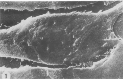 FIG.1.technique,cells. A portion of control TB cell monolayer fixed with glutaraldehyde, prepared by critical point drying coated with gold, and viewed by SEM
