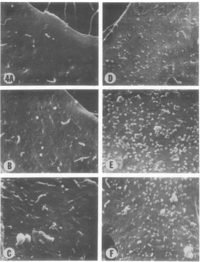 FIG. 4.(B)the Portions of ts 3-infected TB cells incubated at 39 C for different time intervals after infection showing progressive increase in number of viral particles at the cell surface