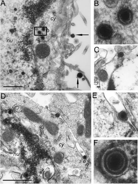 FIG. 5. Virions at different stages of envelopment and egress inbrain cells of MGH1-infected mice