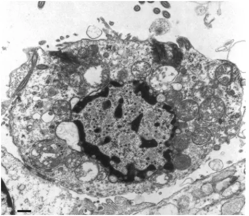 FIG. 6. Cellular distribution of virus particles. The cellular distri-bution and morphology of virus particles in cells of mouse brain cells