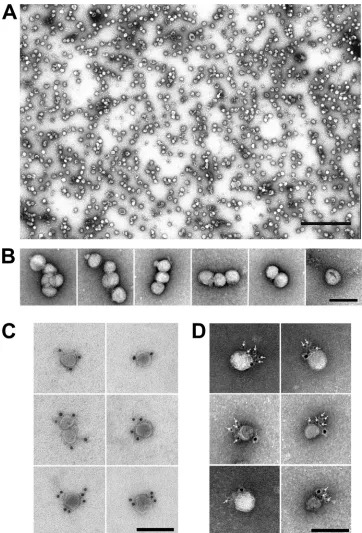 FIG. 2. HCV particles are pleomorphic and display E2 and apolipoprotein E on their surface