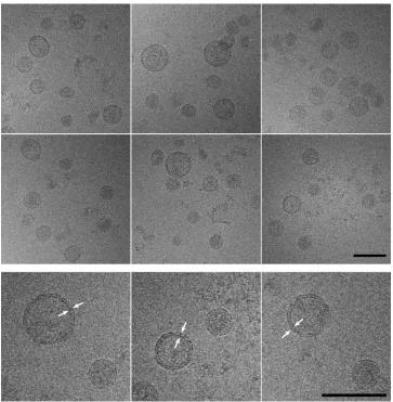FIG. 4. cryoEM showed that puriﬁed HCV particles are predominantly spherical and consist of subpopulations with different diameters