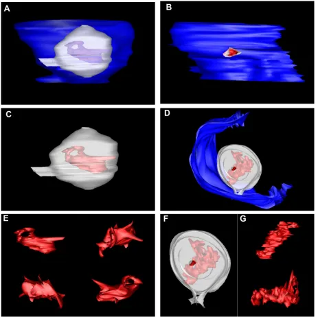FIG. 5. Structural modeling of the viral RNA within the vesicles reveals a complex structure closely aligned to the vesicle pore