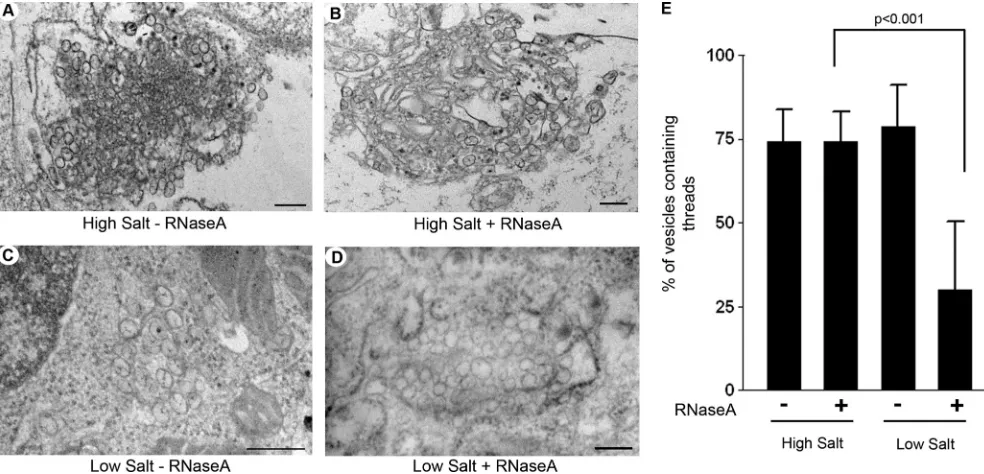 FIG. 6. The majority of viral RNA within the VP is dsRNA. (A and B) Representative images of WNVKUNbe observed, the majority of vesicles within C contain visible threads, which is in stark contrast to the vesicles in D, where very few threads areobserved