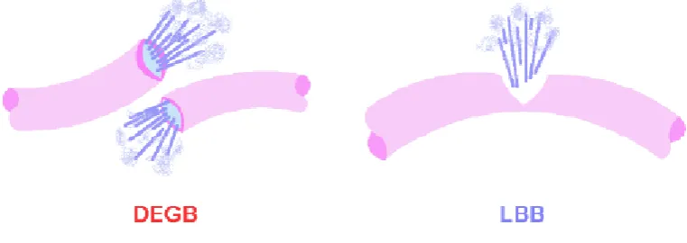 Figure 1：Comparison between DEGB and LBB  