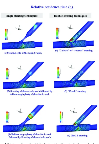 Figure 5. Relative residence time (tr) distribution at the bifurcation for the considered