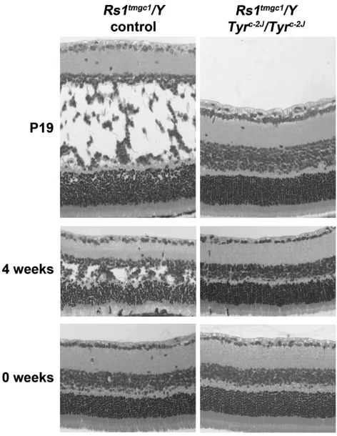 Figure(left) andshown of H&E-stained retinal sections fromweeks (middle), and 16 weeks (bottom) of age