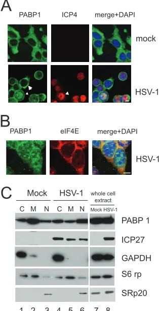 FIG. 1. Confocal microscopy analysis of PABP1 location duringHSV-1 infection. (A) Immunoﬂuorescence microscopy images of the