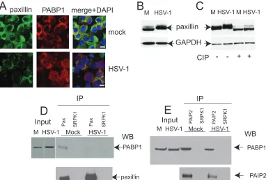 FIG. 4. The interaction of paxillin with PABP1 is disrupted in HSV-1-infected Vero cells