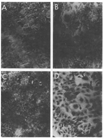 FIG. 3.HuF!WT-2nonpermissivetemperatures.cells Appearance of SV40-transformed human Fanconi cells at the permissive and nonpermissive (A) WT-transformed human Fanconi cells (HuFWT-2) at the permissive temperature, 37 C