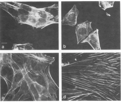 FIG. 4.33seen.daystransformant C; Indirect immunofluorescence using actin antibody (12) of (a) WT4, 33 C; (b) WT4, 41 C; (c) tsA28.3, (d) tsA28.3, 41 C