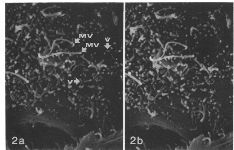 FIG. 2.flatwithstereoscopiclabeledThe VSV virions budding from the plasma membrane of an infected L2 cell 8 h after virus inoculation