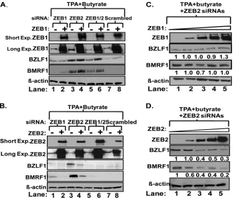 FIG. 9. ZEB1 and ZEB2 compete for binding to Zp in vitroEMSAs in which ZEB1 and ZEB2, synthesized in a cell-free system(TNT), were incubated with a radiolabeled double-stranded WT DNAcorresponding to the ntthe same amount of ZEB1 protein