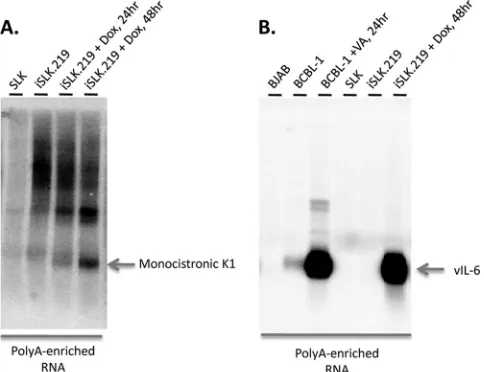 FIG. 4. Northern analysis of K1 and v-IL-6. Poly(A)-enrichedRNAs from indicated cells were resolved by formaldehyde-agarose gel