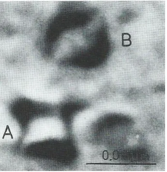 Fig 3 TEM micrograph of coherency strain fields associated with 