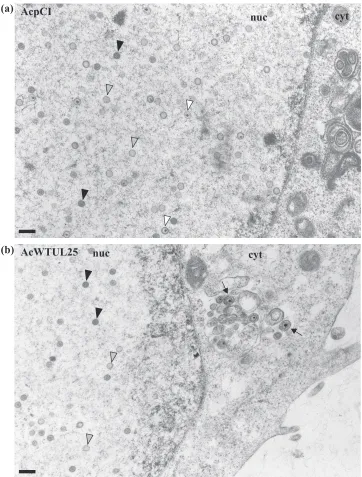 FIG. 5. Analysis of virus assembly in �and the recombinant baculovirus AcpCI (a), AcWTUL25 (b), AcUL25-L3 (c), AcUL25-C4 (d), or AcUL25-L6 (e)