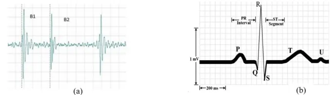 Fig 1: (a) Normal PCG signal, (b) Normal ECG signal 