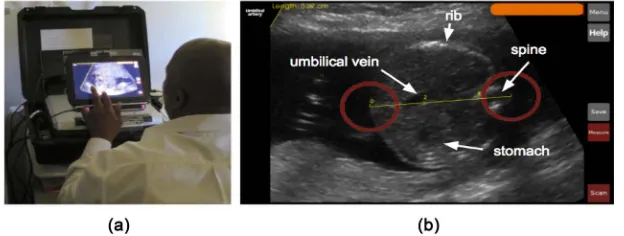 Figure 1. The Umoja ultrasound scanner prototype. (a) A midwife measuring the mean abdominal diameter (MAD); (b) A screenshot of the user interface (UI) of the Umoja scanner