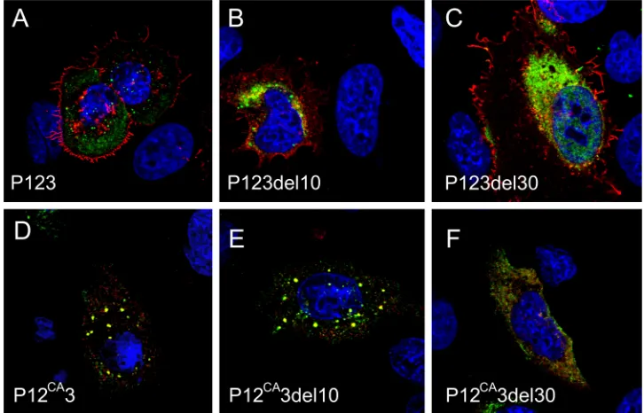FIG. 6. Localization of nsP1 (red) and different forms of nsP3 (green) expressed in the form of polyproteins in transfected HeLa cells