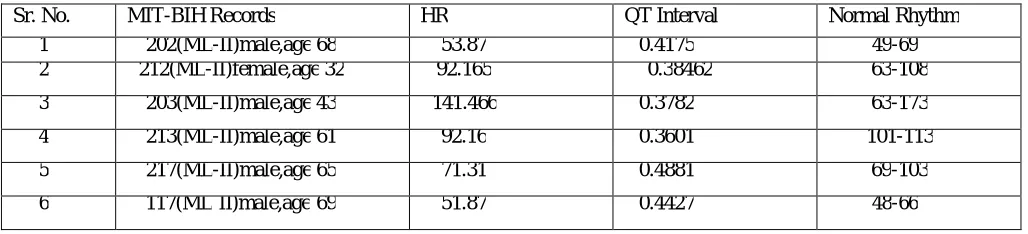 Fig. 6 QT Interval 