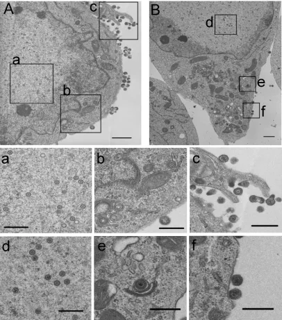 TABLE 1. Electron microscopic localization of HSV-1 virions in infected cells