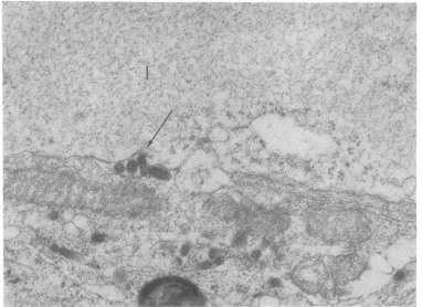 FIG. 11.by an Fixed virus (CVS) infection. Arrow indicates extracellular virions. Upper half of figure is occupied inclusion body ()