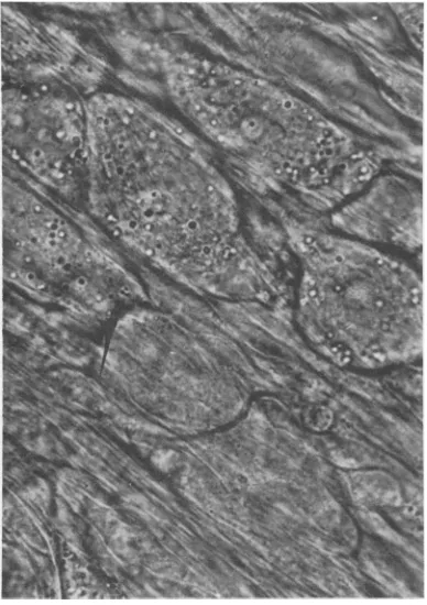 FIG. 2.seenlike Neurons 3 days after infection with rabies- virus strain W56. Cytoplasmic granulationis in most neurons