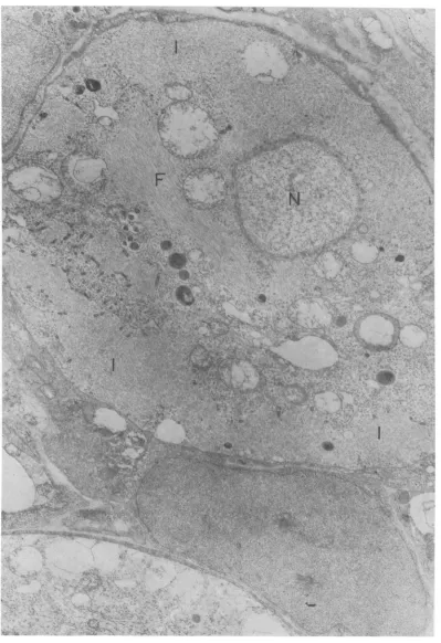 FIG. 5.replacedmicrofilaments.vesicles Rabies virus (W56) infected neurons. Peripheral cytoplasm of the lower neuron is almost completely by inclusion bodies (I)