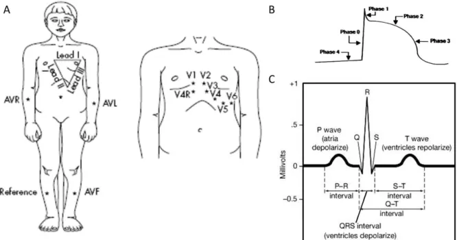 Figure 3: A. Positions of ECG electrodes are indicated and labelled appropriately  [18]