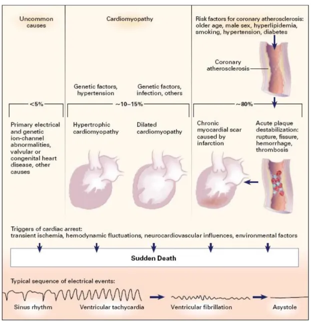 Figure 5: Pathophysiology and epidemiology of SCD  [31]. 