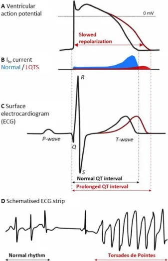Figure 8: A. Normal and prolonged ventricular action potential . B. Normal and reduced I Kr  currents