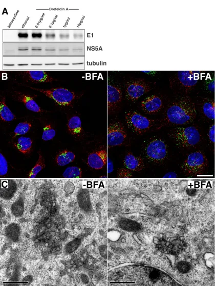 FIG. 8. Effect of brefeldin A on membranous web-like structure formation in UHCV-11 cells