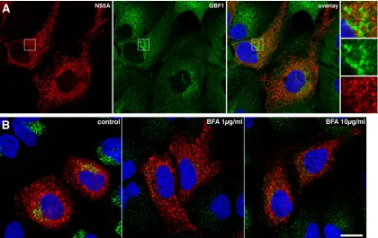 FIG. 5. Immunoﬂuorescence analysis of GBF1 localization and BFA effect in HCV-infected cells