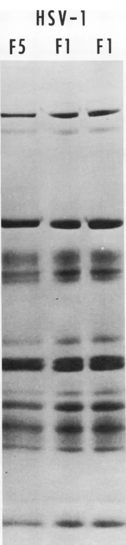 FIG. 3.fromwithcontainingI [Fl Autoradiogram of a polyacrylamide gel slab electrophoretically separated polypeptides two independently purified preparations ofHS V- I virions and from purified virions of a virus strain similar isolation and limited passage history,