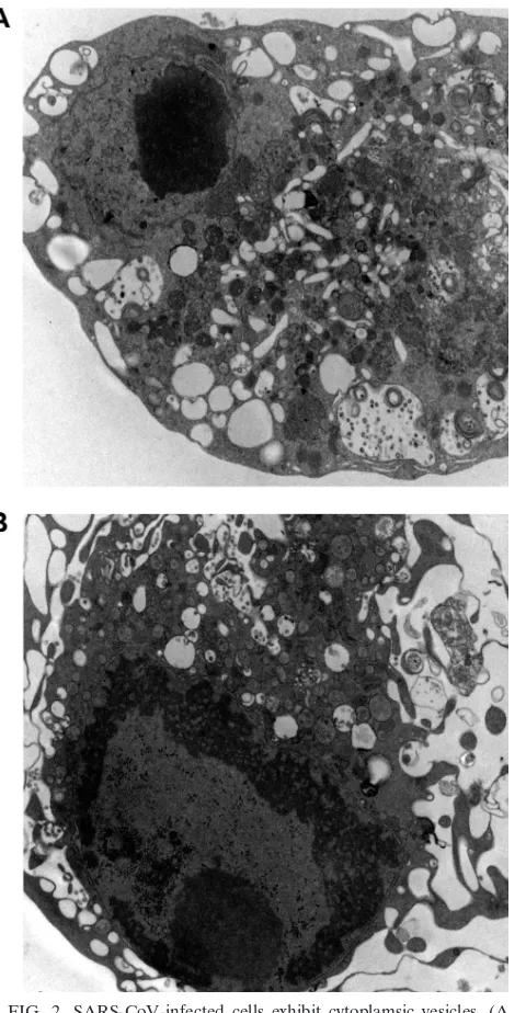 FIG. 2. SARS-CoV-infected cells exhibit cytoplamsic vesicles. (Aand B) Vero cells were infected for 48 h with WT SARS-CoV and were
