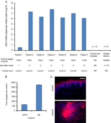 FIG. 1. Signiﬁcant presence of HSV-2 DNA and expression of HSV-2 RNA and antigens in lesion biopsy specimens from individuals withrecurrent mucocutaneous HSV-2 infection