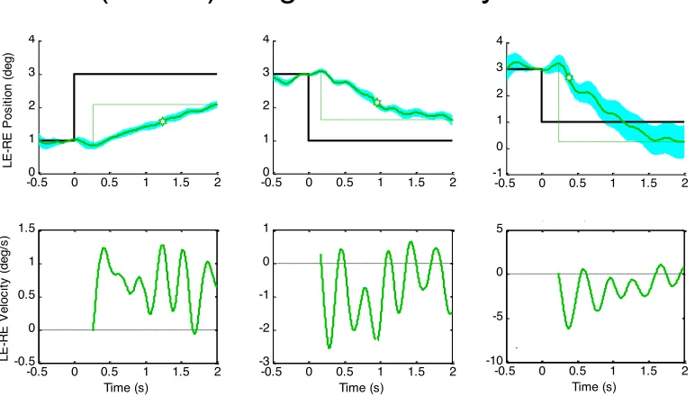 Fig. 10. Assemblage of the mean vergence amplitude (upper plots) and velocity (lower plots) waveforms for a sample of vergence re-sponses meeting the criteria of a duration > 1 and an asymmetry index > 0.5