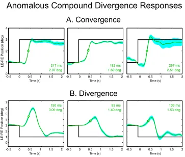 Fig. 12. Averaged convergence and divergence movements (green curves) from three individuals with anomalous compound diver-gence behavior (plotted with the same conventions as Fig