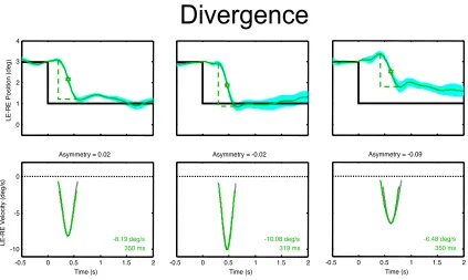 Fig. 5. Examples of typical mean vergence responses and velocity traces for responses showing temporal asymmetries, plotted with the same conventions as Fig
