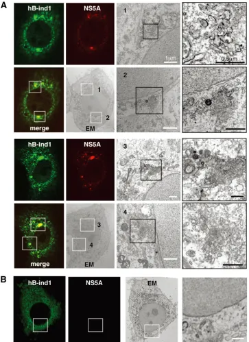 FIG. 5. hB-ind1 interacts with NS5A in the membranous web. Huh9-13 replicon cells were stained with speciﬁc antibodies to hB-ind1 andNS5A