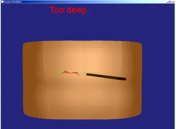 Figure 5.3. Simulator display when cutting too deep 