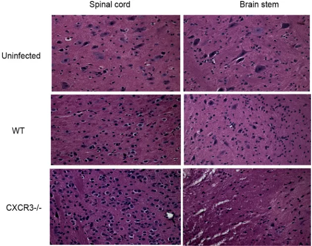 FIG. 2. An increase in neuropathology is evident in HSV-2-infected CXCR3�and CXCR3and spinal cord were removed from each mouse and processed for histological analysis using hematoxylin and eosin staining
