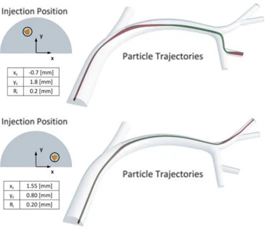 Figure 1. CFD simulation results:  microparticle trajectories in the CHA are dependent on release location [7]   