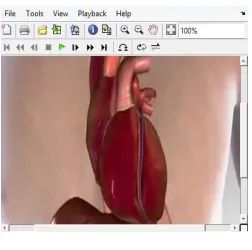 Fig 6  video of heart failure attack 