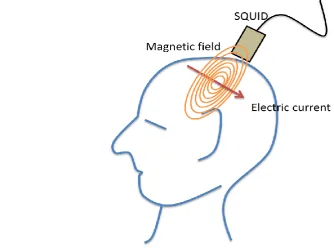 Figure 2.2-2. Measuring MEG 