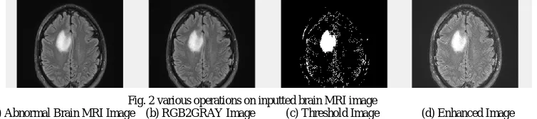 Fig. 2 various operations on inputted brain MRI image             (a) Abnormal Brain MRI Image    (b) RGB2GRAY Image           (c) Threshold Image               (d) Enhanced Image 