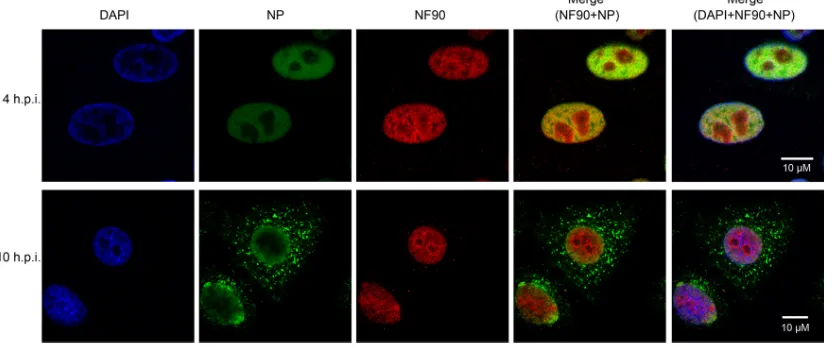 FIG. 3. Intracellular localization of NP and NF90 during inﬂuenza A virus infection. A549 cells were infected with VNM1194 at an MOI of 5.Infected cells were processed for microscopy at 4 and 10 h postinfection (h.p.i.)