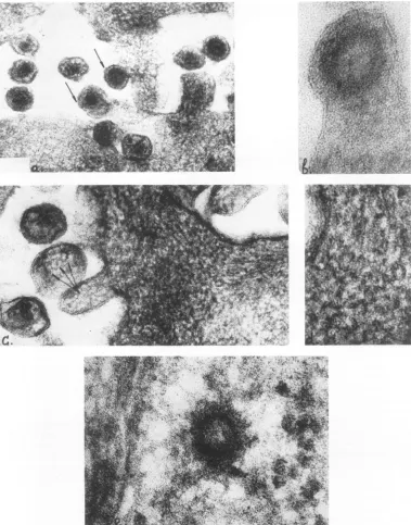 FIG. 8.Buddingnucleoidintercellularnucleocapsids Ultra-thin sections of Detroit-6 cells