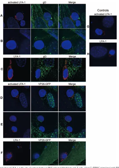 FIG. 6. Detection of LFA-1 at the site of contact between HSV-infected ﬁbroblasts and T cells